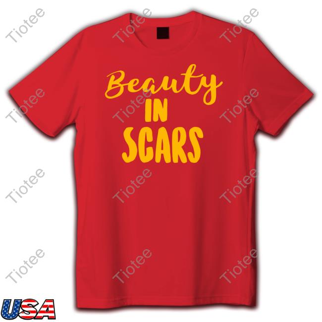 Beauty In Scars New Shirt